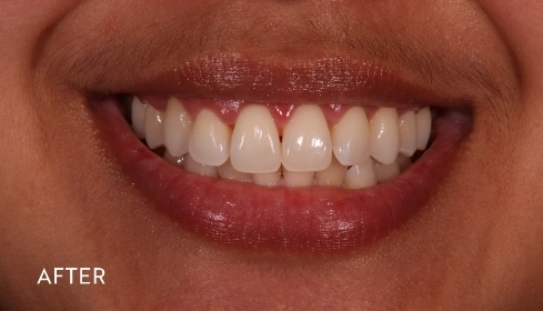 After image 1