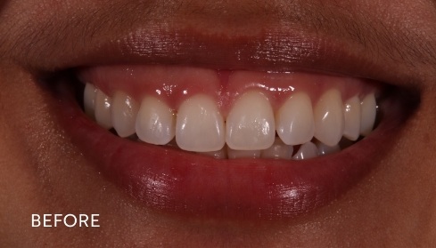 Before image 1