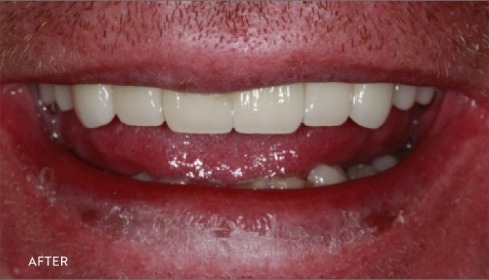 After image 2