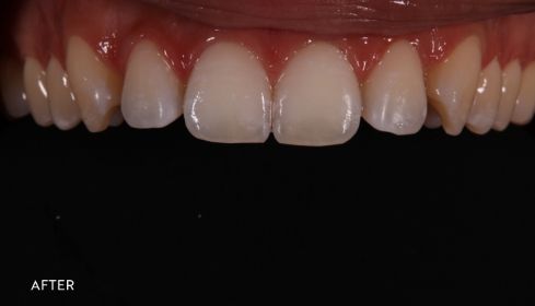 After image 3