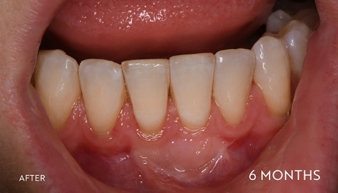 After image 4