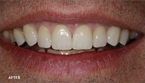 After image 5