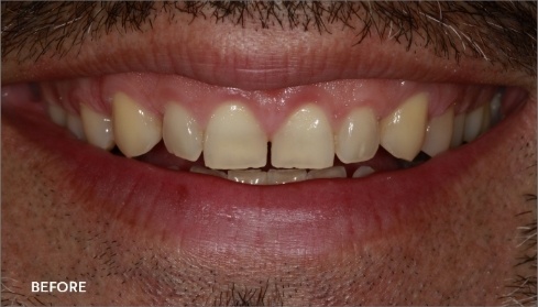 Before image 5