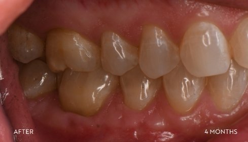 After image 6