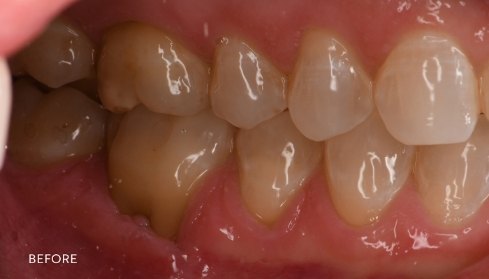 Before image 6
