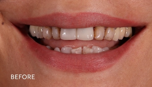 Before image 1