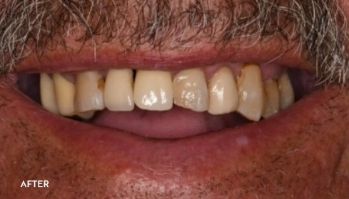 After image 1
