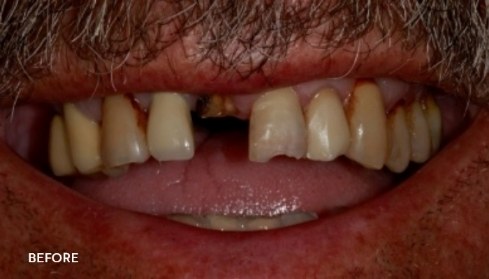 Before image 1