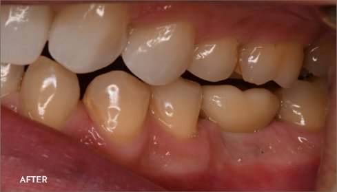 After image 2