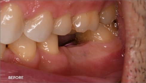 Before image 2