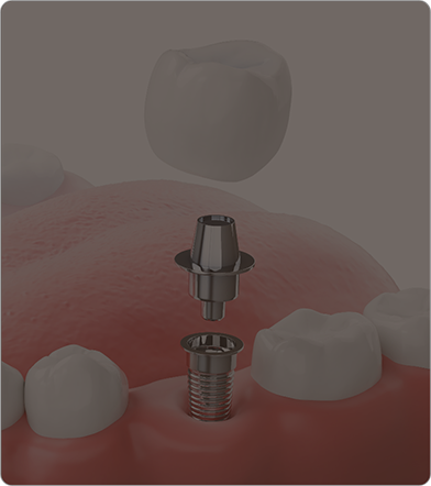 Blonde woman at dental office smiling