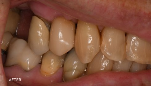 After image 4