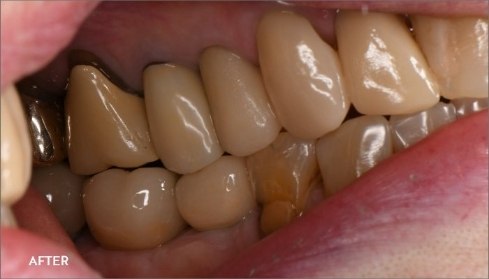 After image 5