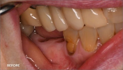 Before image 5