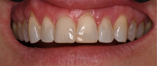 A beautiful smile after cosmetic work