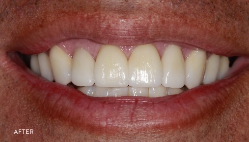 After image 1