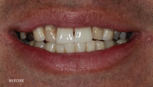 Before image 1