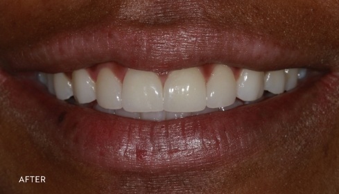 After image 2