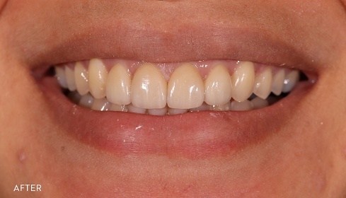 After image 3