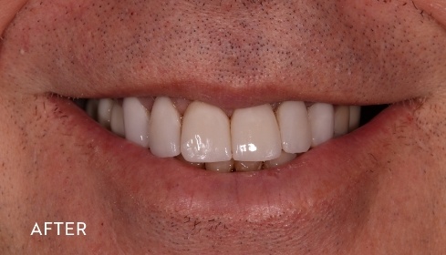 After image 4