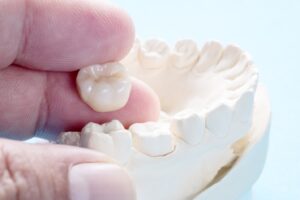 a hand holding a dental crown and mouth mold